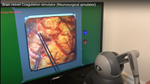 Design and implementation of brain surgery bipolar electrocoagulation simulator using haptic technology