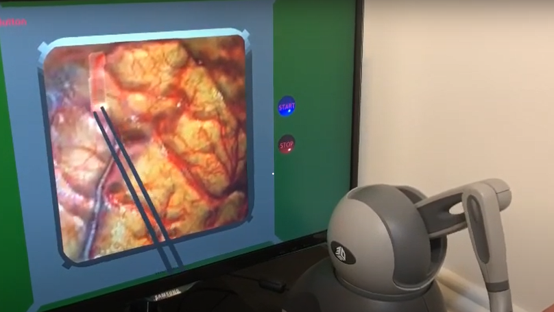 Design and implementation of brain surgery bipolar electrocoagulation simulator using haptic technology